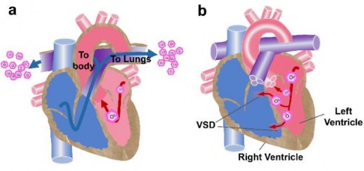 article_VSD_4D_1